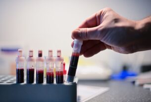 Новини України - Відомо, скільки випадків ВІЛ-інфекції зафіксували в Україні з початку року