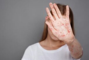 Новини України - В Україні стрімко зростає захворюваність на кір