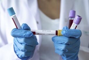 Новини Києва - У Києві зменшилася кількість хворих на COVID-19