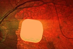 Технології - Британські лікарі частково повернули зір пацієнтам за допомогою мікрочипа