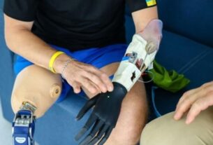 Новини світу - Ісландія виділяє $11,6 млн на протезування українських бійців