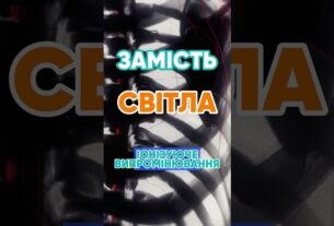Чому рентген показує кістки? 🦴 #наука #цікаво #рентген #медицина