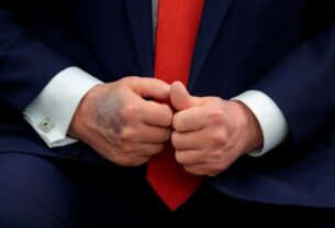 Новини світу - Трамп розповів, звідки у нього синці на руках